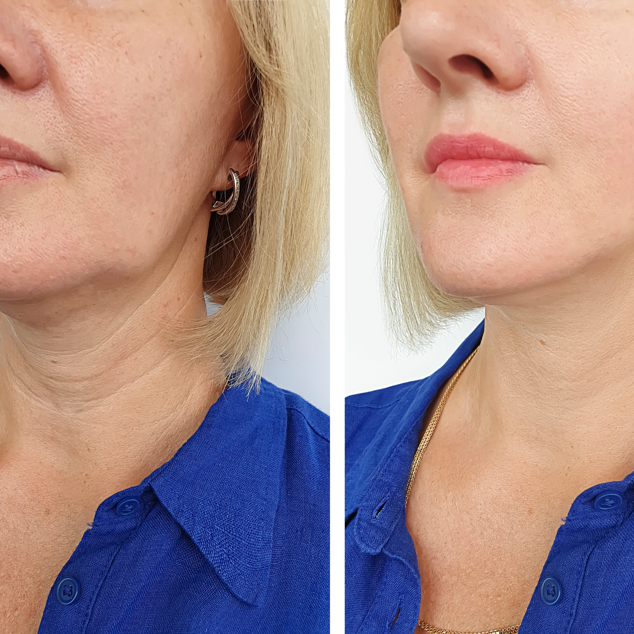 Bare Glow Foundation